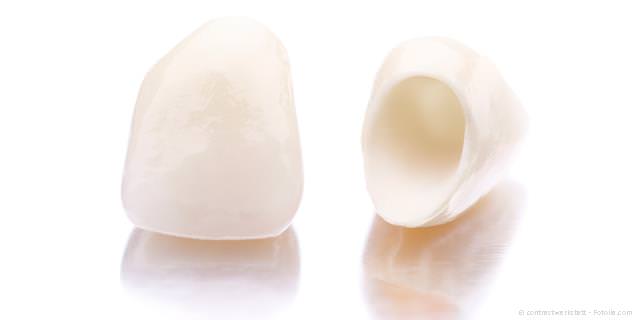 Zahnkronen für stark geschädigte oder abgenutzte Zähne