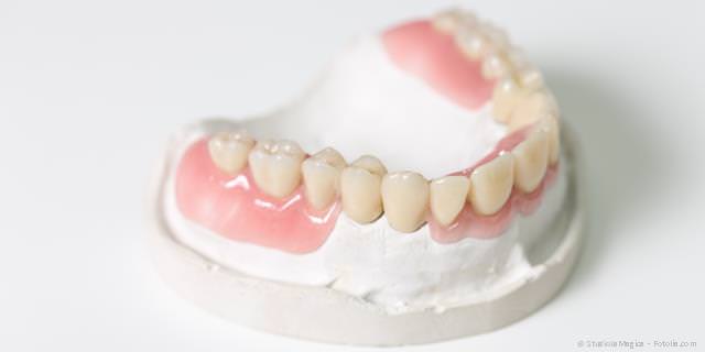 Teilprothesen, wenn viele Zähne fehlen