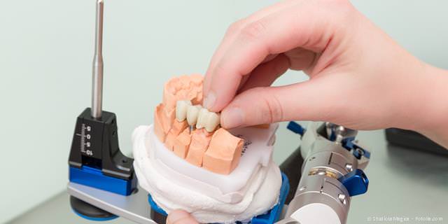 Zahntechnik: Zahnersatz aus dem Meister-Dentallabor